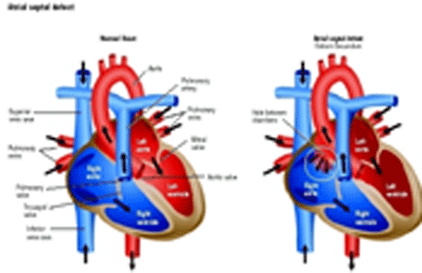 CARDIAC-SHUNTS