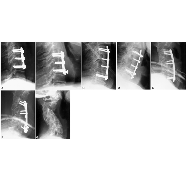 CASPAR-PLATE_02