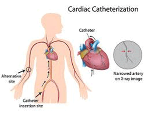 cardic